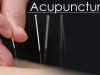 Acupuncture of Weston